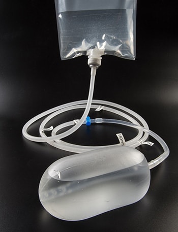 A prototype of the Sinapi uterine balloon tamponade (UBT) inflated with water